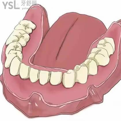南京雅康口腔韓國進(jìn)口種植體價(jià)目表