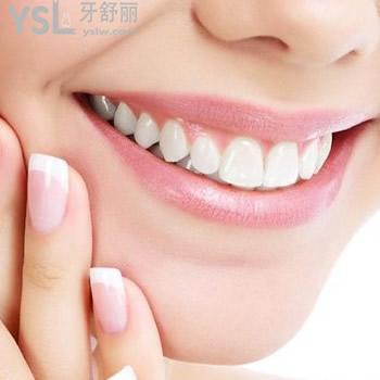 深圳質(zhì)美口腔陶瓷自鎖矯正收費(fèi)貴不貴？