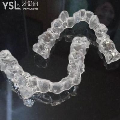 深圳質(zhì)美口腔隱適美隱形矯正矯正齙牙多少錢？