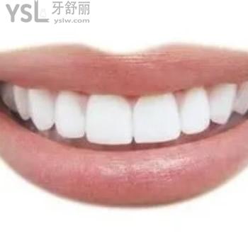 深圳質(zhì)美口腔韓國(guó)奧齒泰種植體包干價(jià)是多少錢？