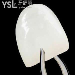 深圳質(zhì)美口腔美國(guó)美加超薄貼面價(jià)格表