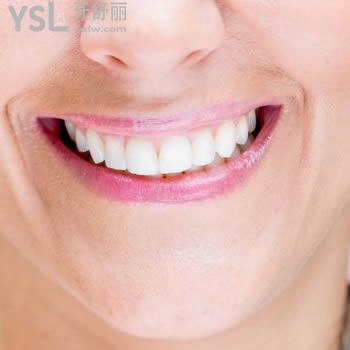 重慶維樂口腔韓國進口種植體+基臺+烤瓷牙冠+手術(shù)費價格表