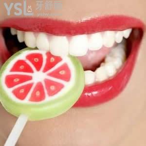 重慶美奧口腔冷光美白收費(fèi)合理嗎？