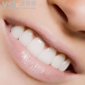 士卓曼種植系統(tǒng)型號(hào)？