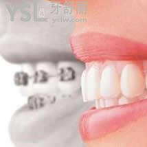 杭州美奧口腔牙齒矯正收費(fèi)多少錢(qián)？