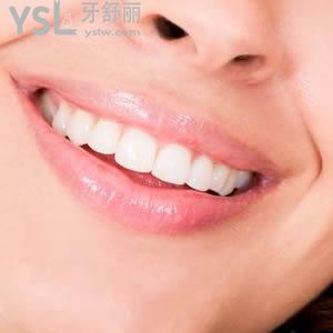 明星為什么不做種植牙？