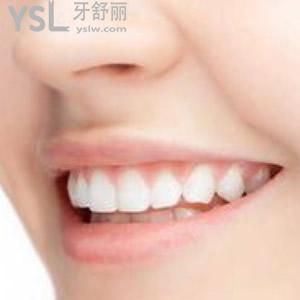 牙齒矯正被坑了一輩子，后遺癥這么多嗎？