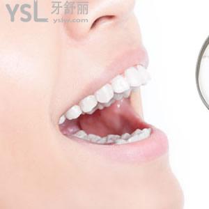 深圳樂莎莎口腔價格表隱形矯正多少錢？