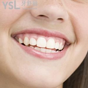 深圳市拜爾口腔門診部收費(fèi)標(biāo)準(zhǔn)時(shí)代天使隱形矯正多少錢？