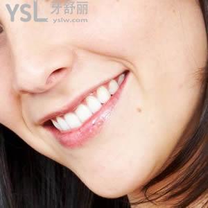 來看一下成都圣貝牙科正雅隱形矯正價(jià)格表