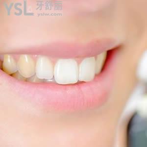 北京圣貝口腔全瓷牙收費(fèi)標(biāo)準(zhǔn)如何。
