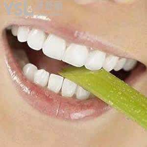 成都極光口腔價(jià)格表MRC咬合誘導(dǎo)暑期超低優(yōu)惠活動(dòng)來襲！