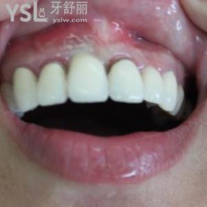 寧波較好的口腔醫(yī)院是哪家？