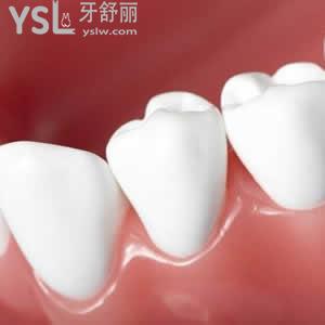 廣州圣貝口腔適美樂隱形矯正價(jià)格怎么樣，貴嗎？