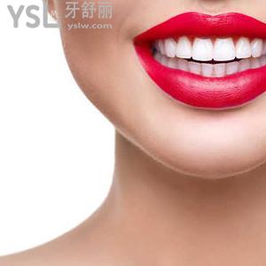 美國種植牙系統(tǒng)價格是多少？