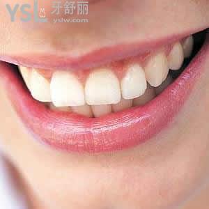 重慶成佳牙博士口腔醫(yī)院瑞典諾貝爾種植牙（基臺+牙冠）多少錢？