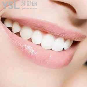 重慶成佳牙博士口腔醫(yī)院隱形矯正（正雅）價格貴嗎？