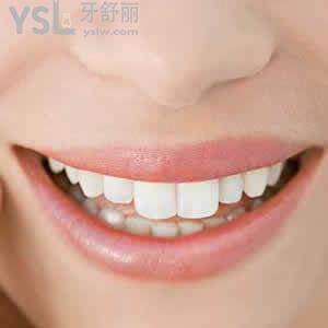 青島牙博士口腔門診部?jī)r(jià)目表之隱形矯正價(jià)格貴嗎？