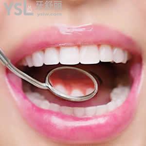 寧波牙博士口腔價(jià)格表之全瓷牙優(yōu)惠價(jià)格