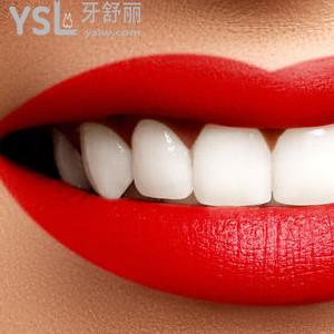 好消息：昆明美奧口腔醫(yī)院正雅全隱形矯正（兩人拼團）驚爆價！