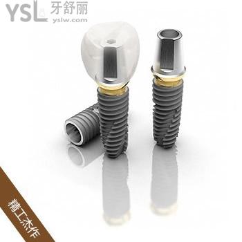 公布?天津中諾口腔價格表，看半口種植牙價格劃算還靠譜
