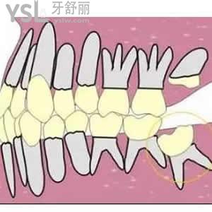 牙科醫(yī)院和醫(yī)院口腔科區(qū)別？