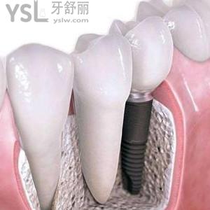 廣東金屬托槽矯正價格多少？珠海九龍口腔價格優(yōu)惠大揭秘