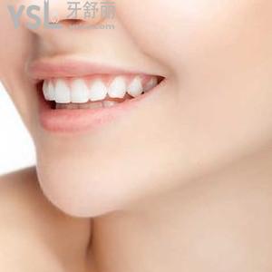鄭州拜博口腔之牙齒美白實力巨惠，安排