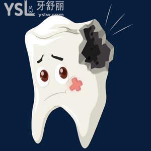 牙齒有洞可以直接拔掉么還是修復(fù)一下比較好？有專業(yè)的醫(yī)生解答嗎？