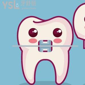 成都新橋口腔之進(jìn)口極速自鎖貴嗎？去過的都說不要太劃算