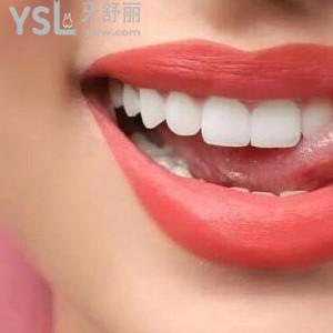 兒童用什么牌子牙膏好？