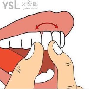 老人牙套價(jià)格一般是多少錢一個(gè)？