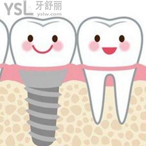 良心醫(yī)生不建議種植牙是真的嗎？
