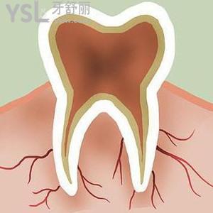 種牙為什么好，二十年經(jīng)驗(yàn)牙醫(yī)可以與你一起探討嗎？