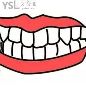 白天老人磨牙齒是什么原因，會(huì)引發(fā)疾病嗎？
