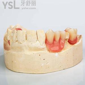 上假牙多少錢一顆？
