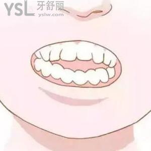 牙齒開合矯正后會改變臉型嗎？