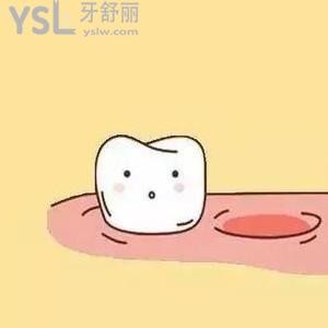 掉一顆牙較好的補(bǔ)救辦法