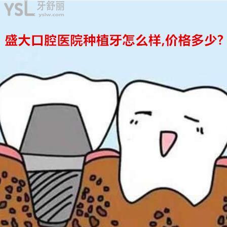 沈陽盛大口腔醫(yī)院種植牙怎么樣,價(jià)格一般多少錢?