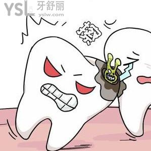 （拔牙后窟窿圖）智齒拔完后洞多久？