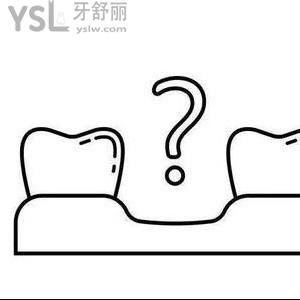 牙齒缺失一半的較好修復(fù)方法有嗎？