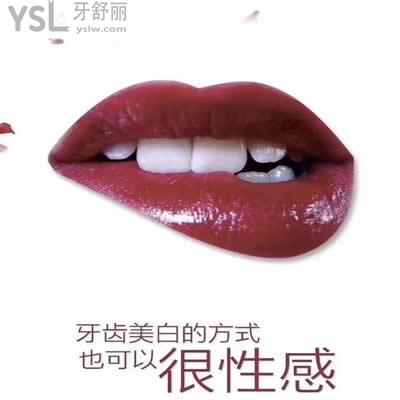 冰瓷牙貼面能維持多久？