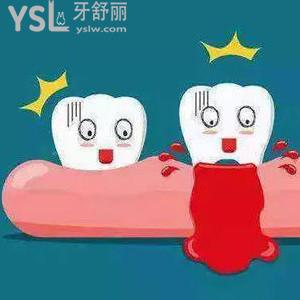 因牙周炎牙全拔掉了要補(bǔ)牙嗎