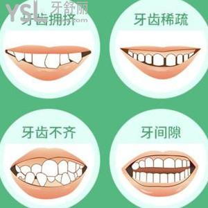 中年人牙齒矯正好不好，牙齒矯正年齡有關(guān)系嗎？