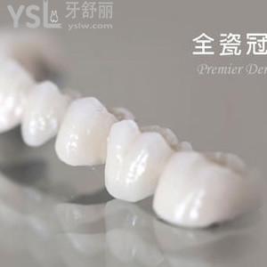 800元一顆是全瓷牙嗎