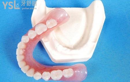 固定義齒修復的缺點有哪些？