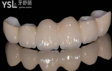 全瓷牙和二氧化鋯區(qū)有什么不一樣？