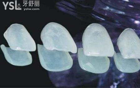 烤瓷牙貼面能使用多久？