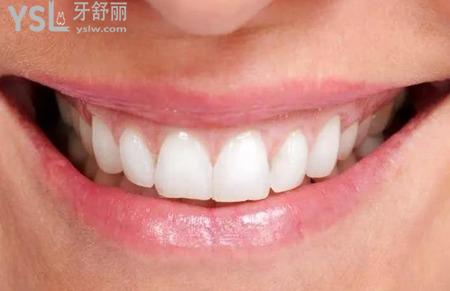 孕婦用什么牙膏？