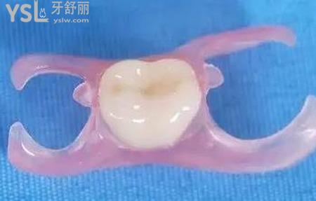 固定義齒的禁忌癥有哪些？
